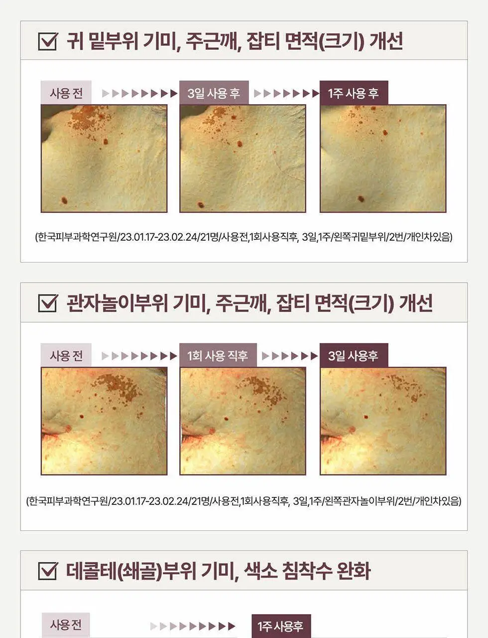 [잡티앰플/대용량]센텔리안24 엑스퍼트 마데카 멜라 캡처 앰플 맥스 45ml 상세페이지 15